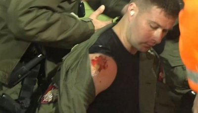 Žandarm povređen na derbiju ispred juga: Krvavom mu ukazivali pomoć, pa ga izveli sa Marakane!
